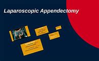 Image result for Laparoscopic Appendectomy SRB Book