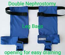 Image result for Nephrastomy Bag
