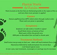 Image result for Plantar Wart Anatomy