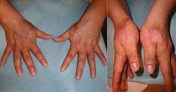 Image result for Hand Skin