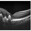 Image result for Retinal Scan