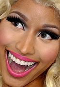 Image result for Nicki Minaj Real Teeth