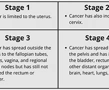 Image result for Endometrial Cancer Stage 2B