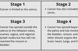 Image result for Endometrial Cancer Staging Table