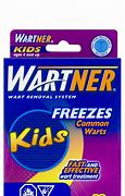 Image result for Kids Wart Remover