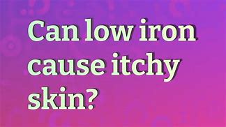 Image result for Low Iron Memes