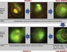 Image result for Vibrio Skin Infection