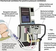 Image result for Mechanical Ventilator Modes