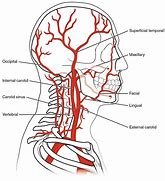 Image result for Carotid Sinus On a Person