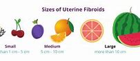 Image result for Fibroid Size Orange