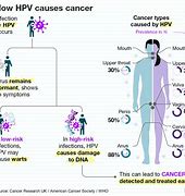 Image result for HPV Lesions in Men