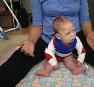 Image result for Babies with Cerebral Palsy