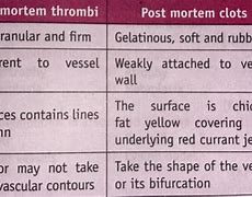 Image result for Post-Mortem Sponge