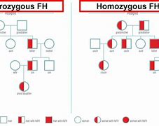 Image result for Homozygous Familial Hypercholesterolemia