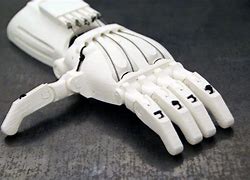 Image result for prosthetics hands 3d print