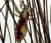 Image result for What Does a Lice Look Like Picture