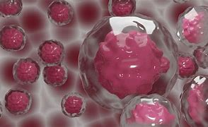Image result for Circulating Tumor Cells