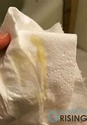 Image result for Cervical Mucus Plug