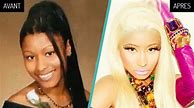 Image result for Nicki Minaj Before and After