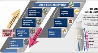 Image result for Dairy Allergy