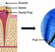 culture of Dental Pulp-এর ছবি ফলাফল. আকার: 195 x 174. সূত্র: www.liebertpub.com