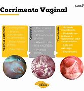 Image result for ac9rrimiento