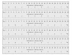 Image result for Ruler Measurements Centimeters