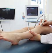 Image result for Vascular Ultrasound Machine