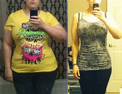 Image result for 65 Lb Weight Loss Before After Woman