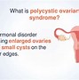 Image result for Polycystic Ovary Syndrome Symptoms