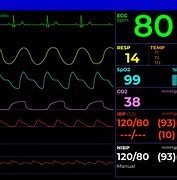 Image result for Philips Hemocalc Screen