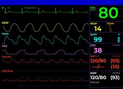 Image result for Pulse Monitor Hospital