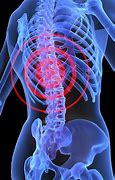 Image result for Back Injuries