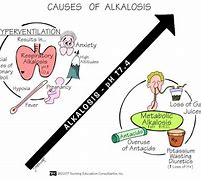 Image result for alcakosis