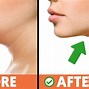 Image result for Jaw Exercises for Jawline