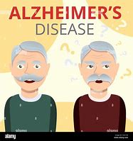Image result for Alzheimer Cartoon