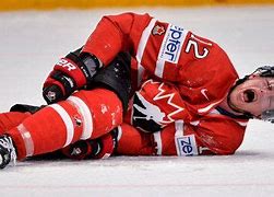 Image result for Hockey Injuries AC Joint