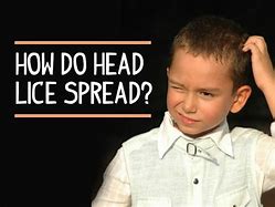 Image result for Large Head Lice