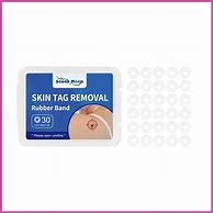 Image result for Skin Tag Remover Bands