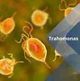 Image result for Trichomoniasis Symptoms Men