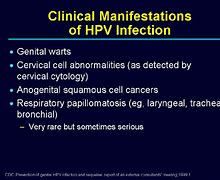 Image result for Male HPV Throat Cancer