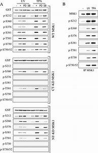 Image result for Hek 293 T Cells and Camkⅱ