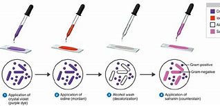 Image result for Gram Stain Process