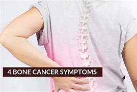 Image result for Collar Bone Cancer Symptoms