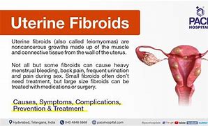 Image result for What Do Fibroids Look Like
