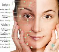 Image result for Woman Face Aging Skin