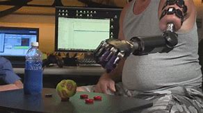 Image result for Prosthetic Arms