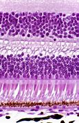 Image result for Ganglion Cell Layer Retina