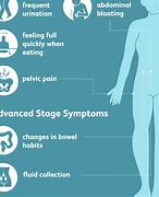 Image result for Ovarian Cancer and Back Pain