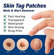 Image result for Skin Fix Skin Tag Remover